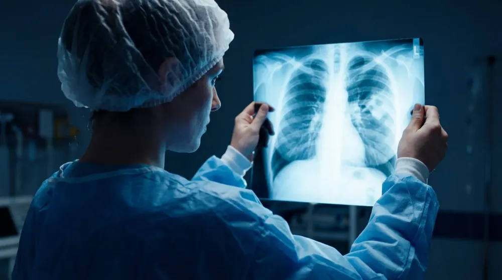 Radiographie rayons X