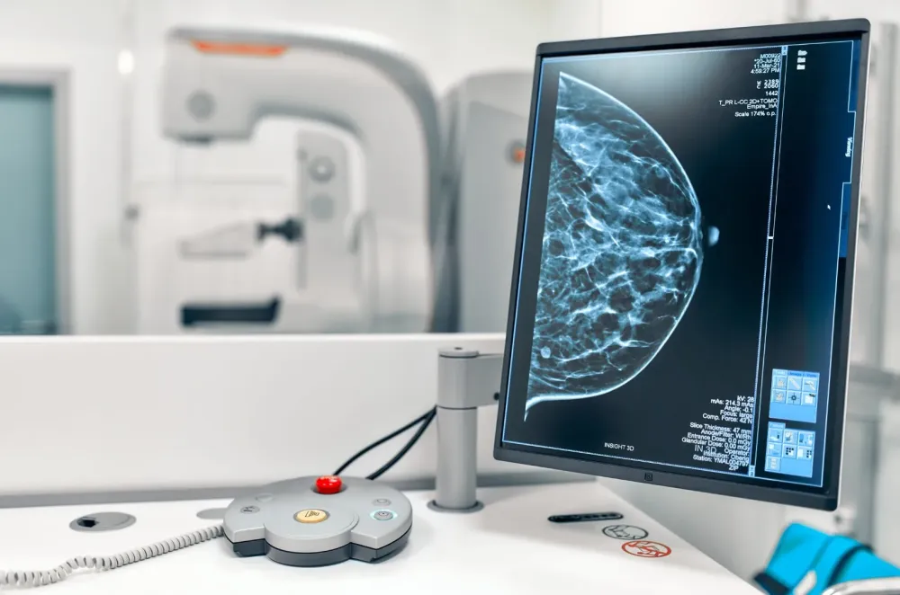 examen Mammographie
