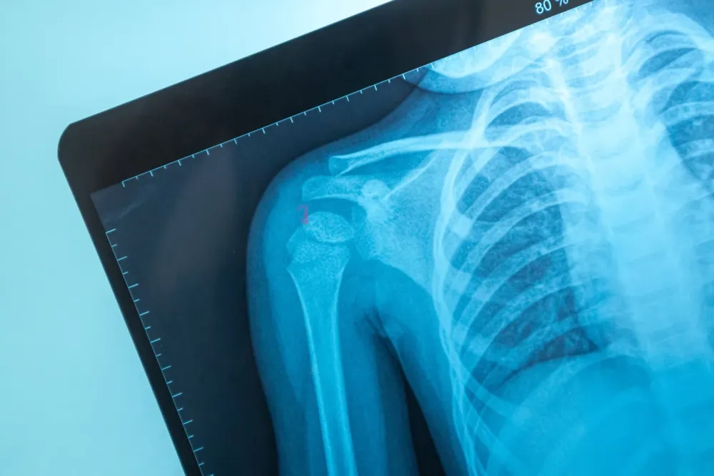 Radiologie à Arès